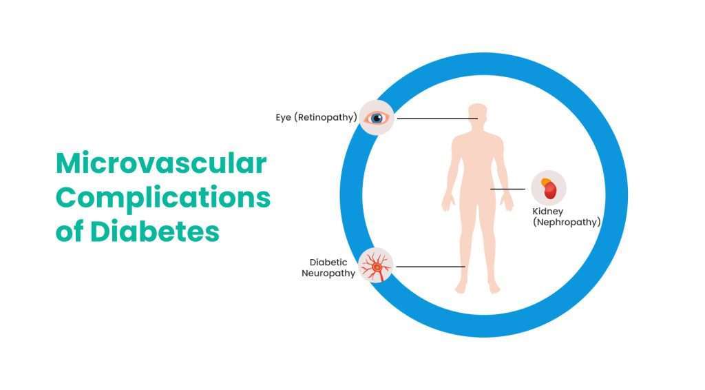 Microvascular Complications of Diabetes - Wellfinity.in