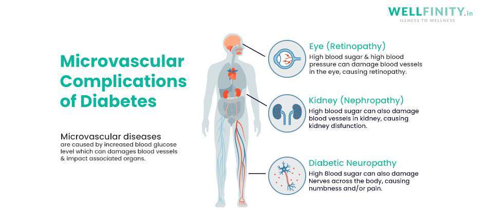 Microvascular Complications of Diabetes Infographic - Wellfinity.in