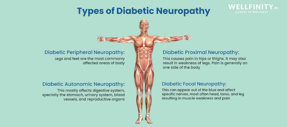 Diabetic Neuropathy Types - Wellfinity.in